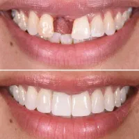 ارائه خدمات  دندانپزشکی با تخفیف ویژه