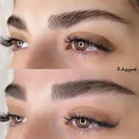 تخفیف جدیدترین میکروبلیدینگ هایپرلیفت نچرال فیبروز