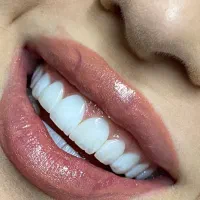 کامپوزیت لیرینگ لمینیت