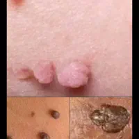 اگه از زیگیل و درمانش خسته شدی این اگهی واسه خودته