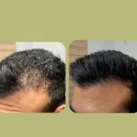 بازگشت . تضمینی