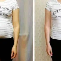 لاغری کامل یا موضعی با دستگاه و مشاوره