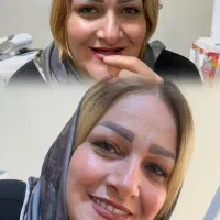 دندان مصنوعی با متد جدید بدون لقی / دندانسازی