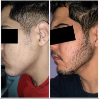 خسته نشدی از بی ریشی