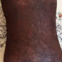 مشک ب