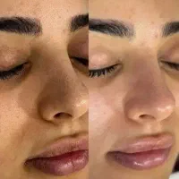فشیال تخصصی پوست تخفیف ویژه مراجعه اول