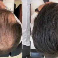 دیگر نیازی به پوشاندن سرتان نیست مو را به رخ بکشید
