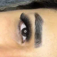 کاشت مژه
