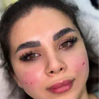 فیلر ،بوتاکس،مزو ،مزوژل،لیفت بانخ