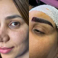 جشنواره کاشت ابرو با تخفیف ویژه (ظرفیت محدود)