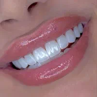 دندانپزشکی اقساط،عصب کشی،کامپوزیت دندان،اطفال