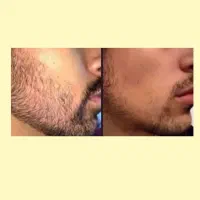 زیبایی به خودت هدیه بده