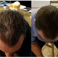 با موهات بهترین ورژن خودت باش