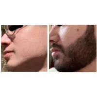 پر پشتی ریش و سبیل