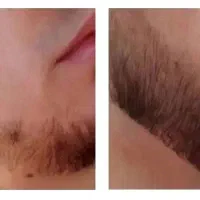 رویش تضمینی