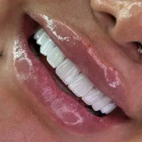 کامپوزیت طبیعی اقساطی