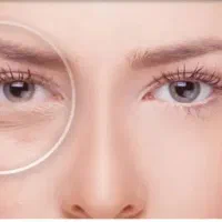 تزریق انواع بوتاکس و ژل ومزوژل