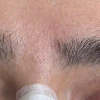 اصلاح صورت و اصلاح ابرو