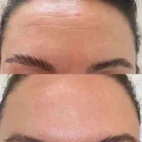 حل مشکلات پوستی به صورت دائمی