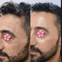 180درجه عوض شو
