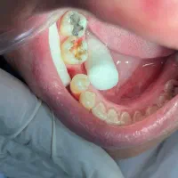 دندانپزشکی و دندانسازی ۴۰٪ افر