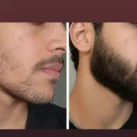 ریشت امضا و ابهت توعه رو صورتت