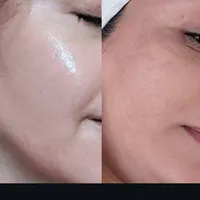 فیشیال پاکسازی و درمان تضمینی پوست|خدمات آرایشگری و زیبایی|کرمانشاه, |دیوار