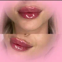ژل گونه چونه زاویه سازی درجشنواره مشاوره رایگان