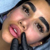 خدمات ژل و بوتاکس وفیلربادی و هیپ دیپ
