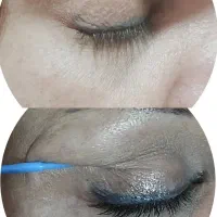 پاک کردن تتو های قدیمی و احیای ابرو