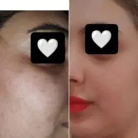 ساخت انواع کرم و عمده و تکی کرم vip