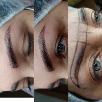 تخفیف میکروبلیدینگ و میکروپیگمنتیشن ابرو رشت