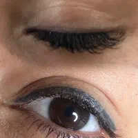 خانه تخصصی انواع ریموو تاتو‌صورت
