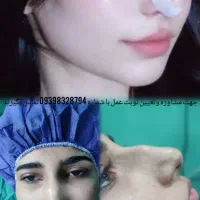 عمل بینی در اهواز۳۵م