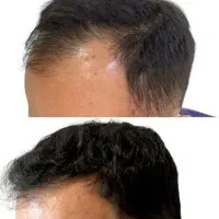با (ریش) جذاب تری
