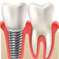 خدمات دندان پزشکی بدون پیش پرداخت