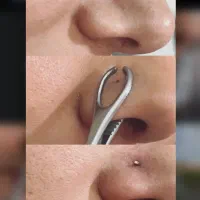 رنت اجاره دستگاه لیزر دکا