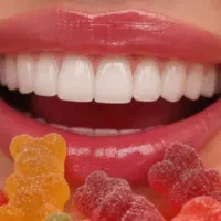 کامپوزیت برای داشتن لبخندی زیبا
