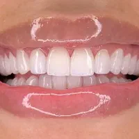 کامپوزیت صدفی هر فک 5/980جشنواره تخفیفی