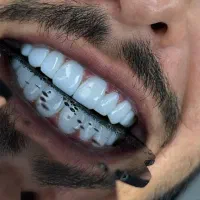 لمینت/کامپوزیت/مدل/روکش