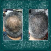 برگشت مو به سوی اوست