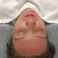 مزونیدلینگ میکرونیدلینگ