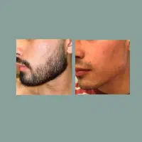 ریشو باش|آرایشی، بهداشتی، درمانی|سیرجان, |دیوار