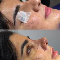 عمل بینی