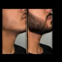 فقط با یک دوره معجزه رو ببین