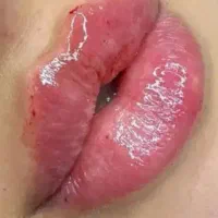 خدمات تخصصی فیلر صورت و بوتاکس