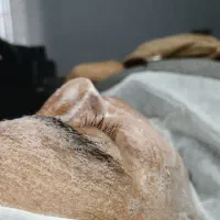 پاکسازی یا فیشیال پوست