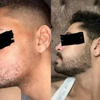 آنالیز استایل صورت