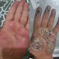 طب سنتی