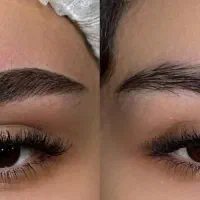 میکرو ، میکروبلید، فیبروز ، نانوبروز